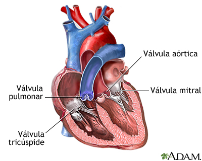Enfermedad cardíaca: soplo cardíaco